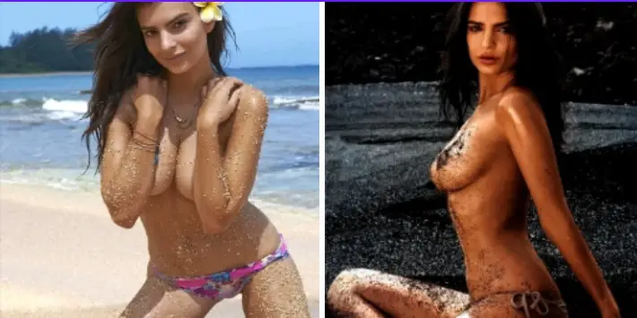 Emily ratjkowski In Tiny Bikini Bottoms & A Crop Top, Leaving Little To Imagination, Fans Raise Concern Saying “She Genuinely Needs Help”